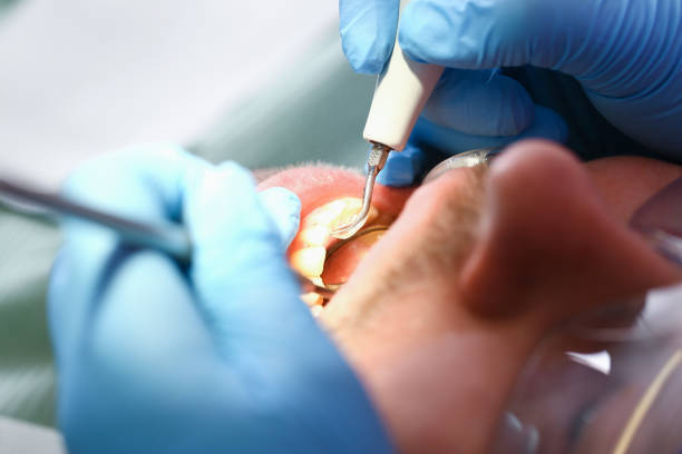 Best Broken or Chipped Tooth Repair in Adrian, MI
