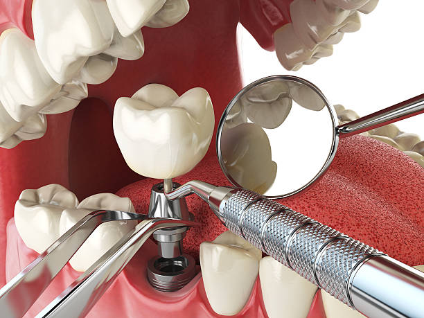 Best Dental Abscess Treatment in Adrian, MI